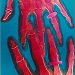 Isaac Kitrosser, Chromogenic X-ray
